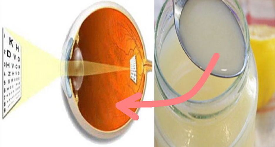 Rețeta contra miopiei îți poate reda vederea de odinioara …! Folosește-o înainte de culcare și îți vei îmbunătăți vederea cu 80%!