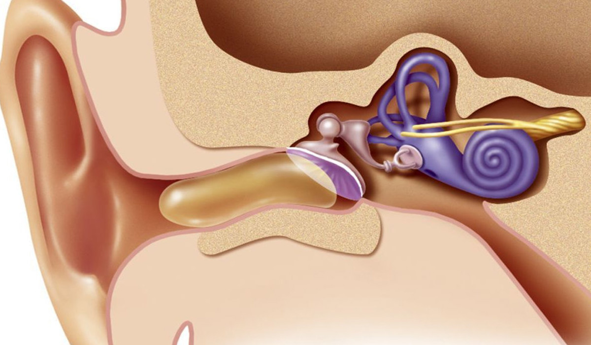 Cu ce se scoate dopul de ceara din ureche: Recomandarea medicilor ORL-isti