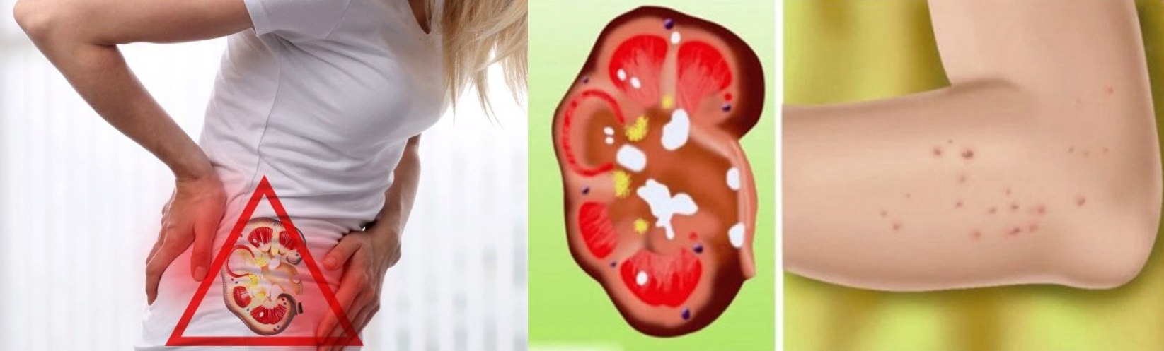 Dacă te dor rinichii, corpul prezintă aceste 8 semnale de alarmă