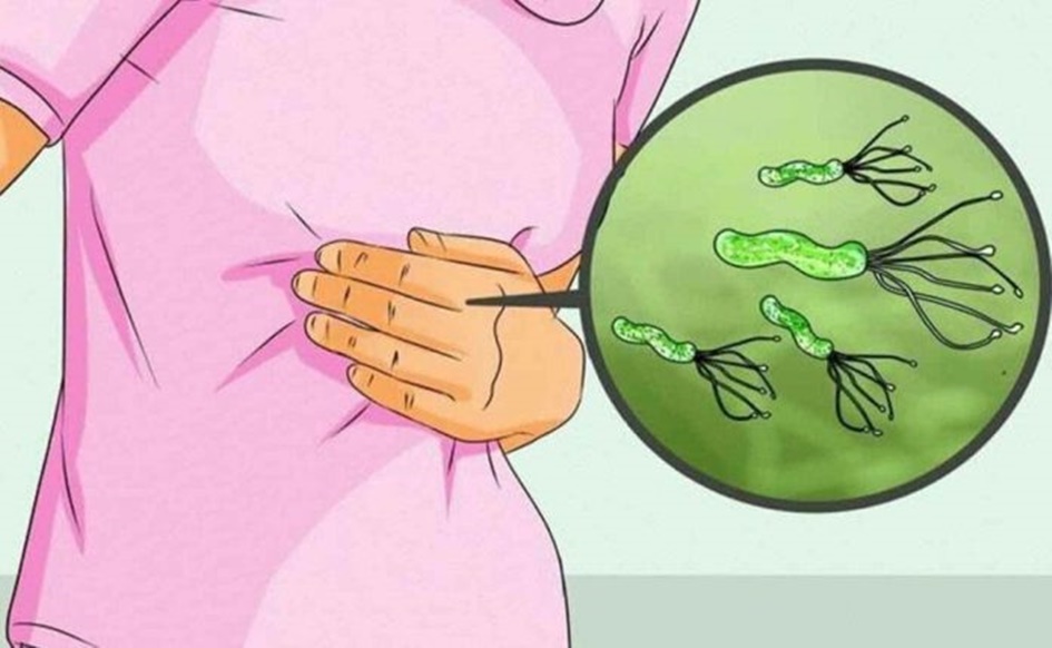 Semne că aveți bacterii Helicobacter în intestin: modalitati naturale de a lupta împotriva acestora