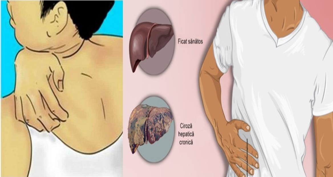 8 semne neașteptate ale afecțiunilor hepatice