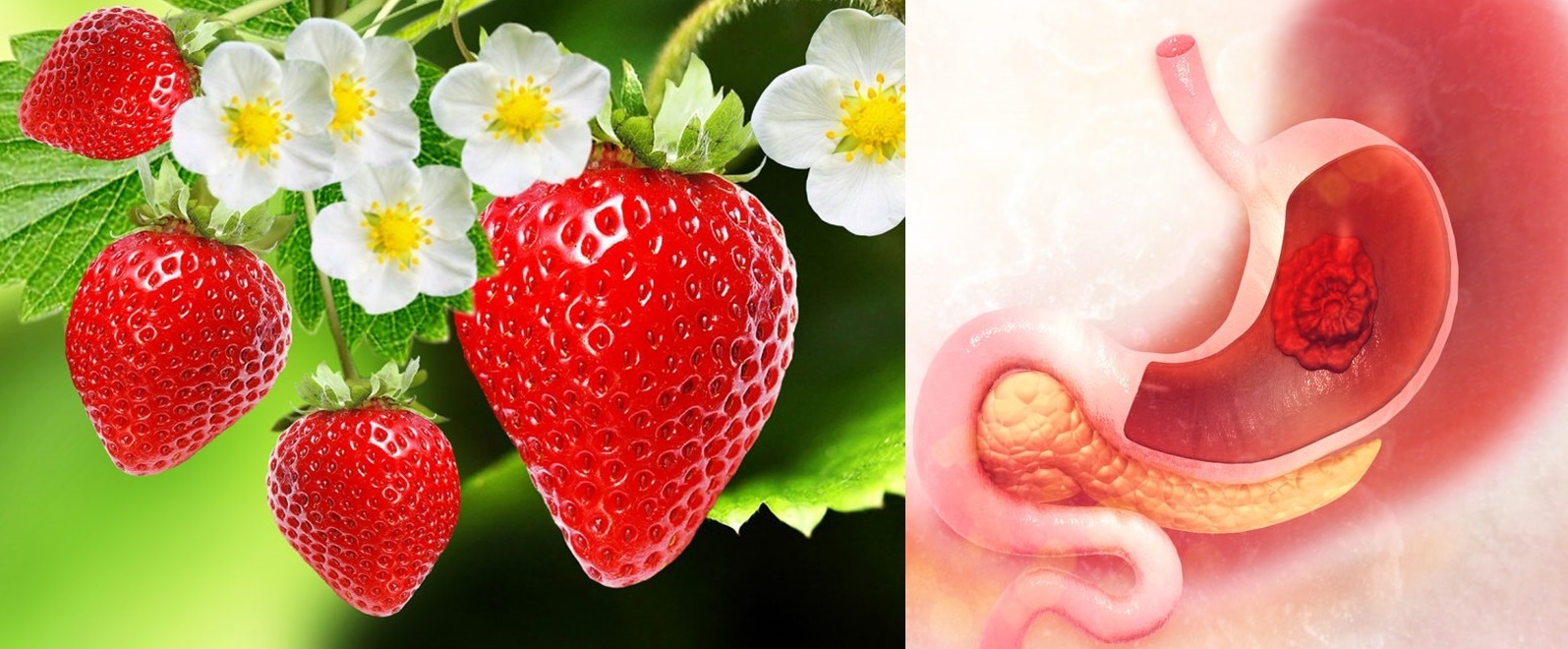 Vindecă-ți gastrita cu aceste 7 remedii naturiste