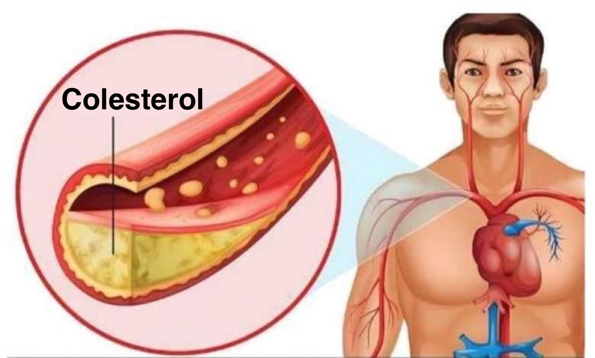 10 Alimente surprinzătoare care scad rapid colesterolul