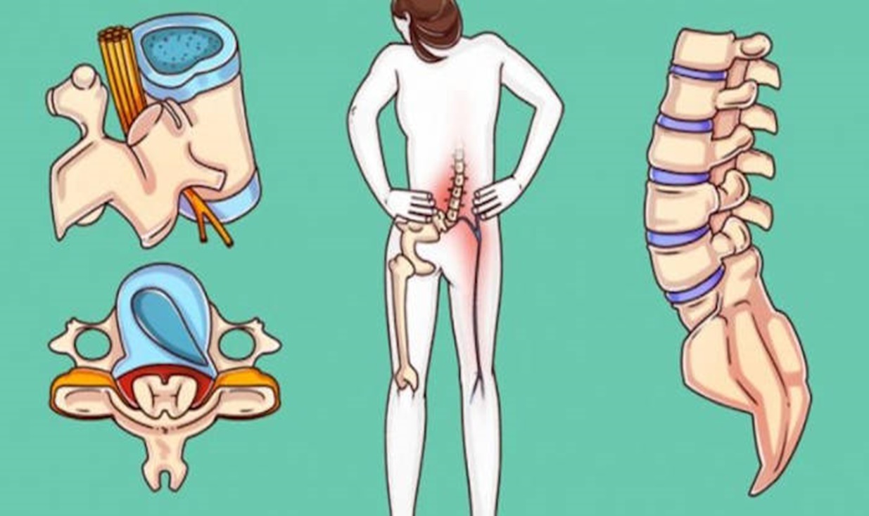 Sfaturile unui chirurg celebru pentru ameliorarea durerilor de spate – urmează-le înainte de a fi prea târziu